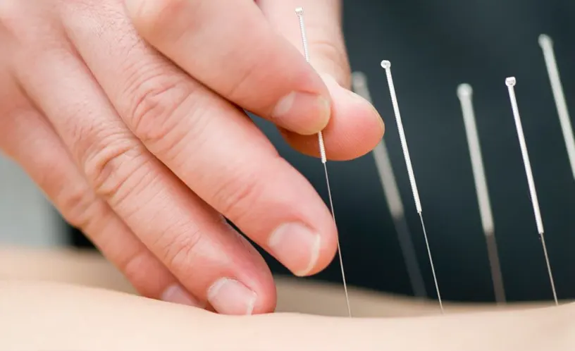 Acupuncture for Fertility &amp; Women's Health